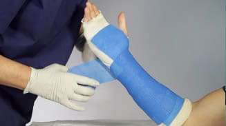 Plaster Treatment for Simple and hairline Fracture